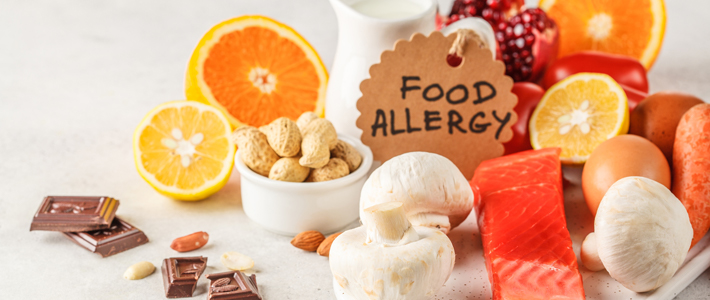 食品アレルギーのイメージ